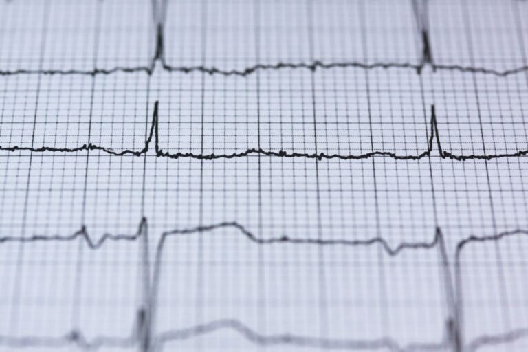 A Deep Dive into OBD-II Mode $06: How to Interpret Non-Continuous Monitor Test Results - partpickerauto